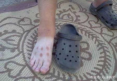 搞笑照片:不要在网上买三块钱的拖鞋,他会让你穿到绝望