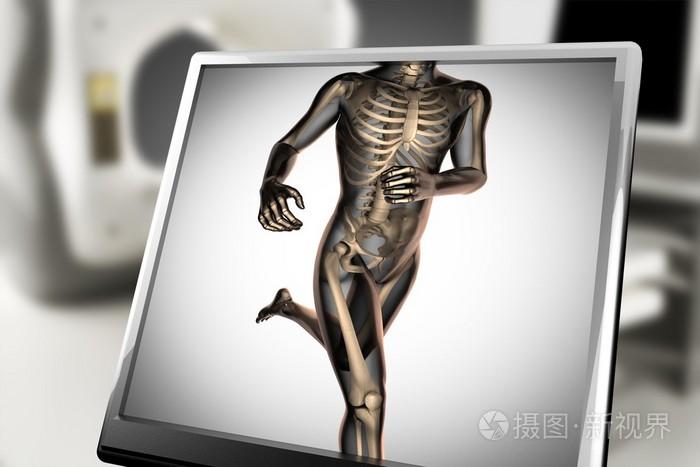 人体骨骼放射扫描图像