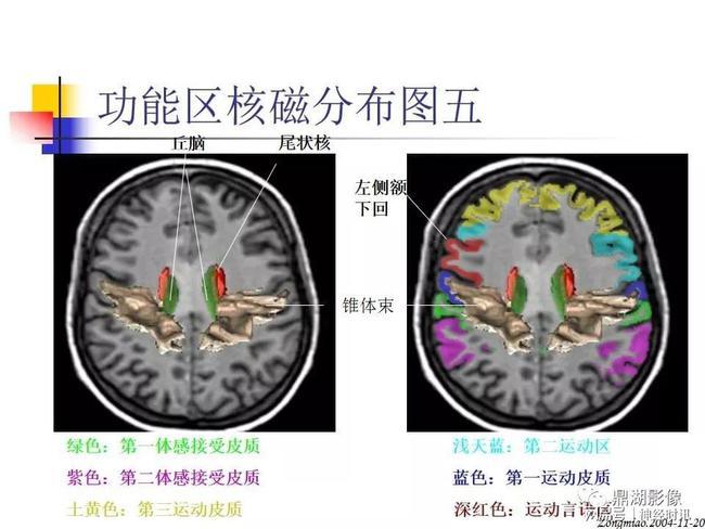 脑磁共振局部解剖功能图谱
