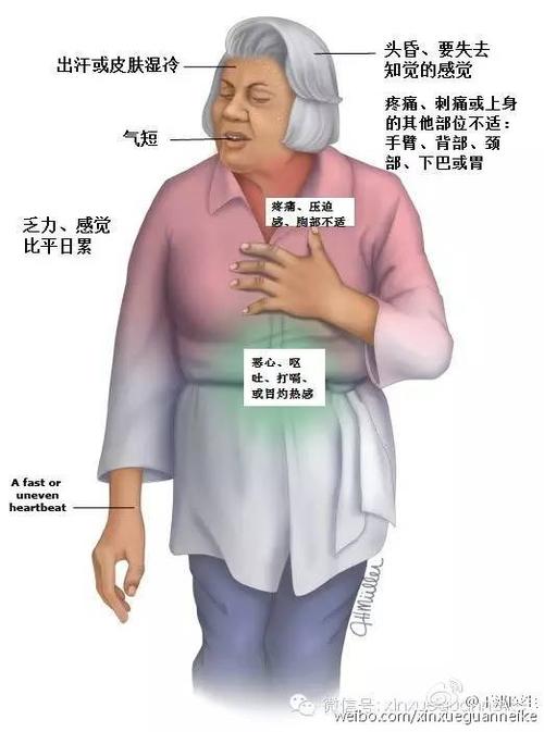 教你了解冠心病的早期症状,三级预防都有哪些?