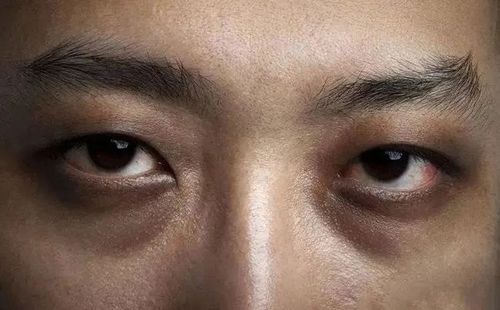 30岁男子,滴酒不沾,查出肝癌,医生感叹:吃的太不好了