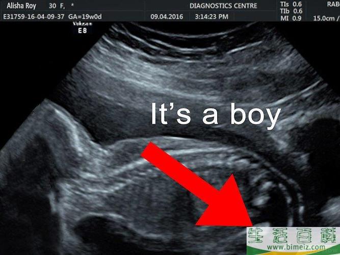 如何看超声图像