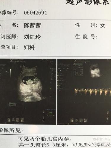 双胞宝宝,孕11周 5天,大家看看是男宝女宝