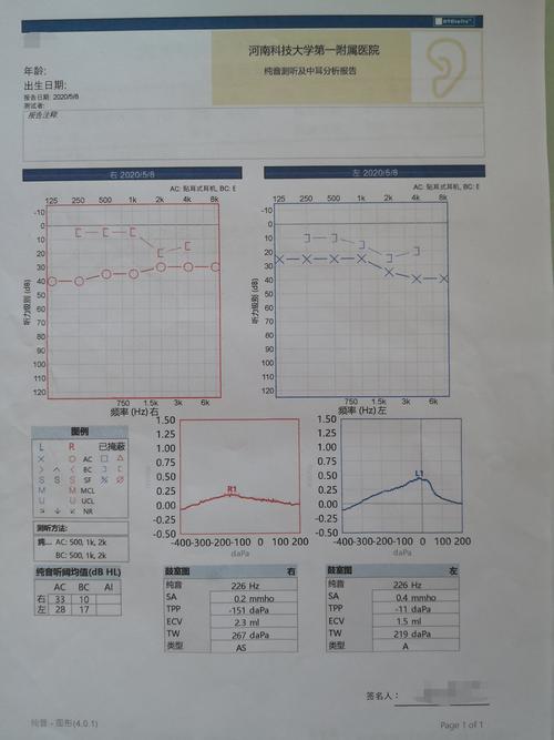 其它 "镜面人"的耳部纤维手术 写美篇 1,纯音听阈测试示:双耳听力下降