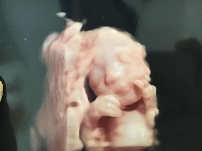 怀孕33周胎儿发育_孕妇变化_怀孕注意事项