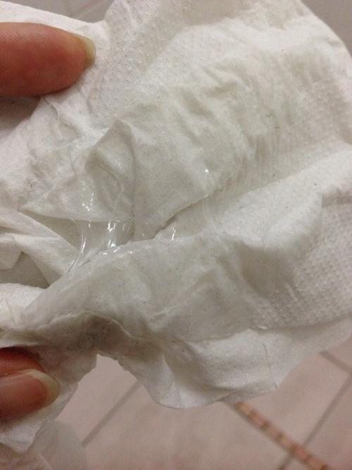 白带拉丝白带拉丝排卵