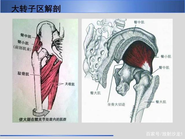 股骨大转子疼痛综合征mr特征