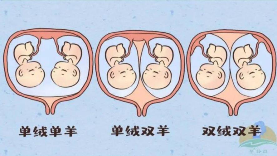 【小概率事件中的小概率事件】双胞胎太要好 急坏父母医生