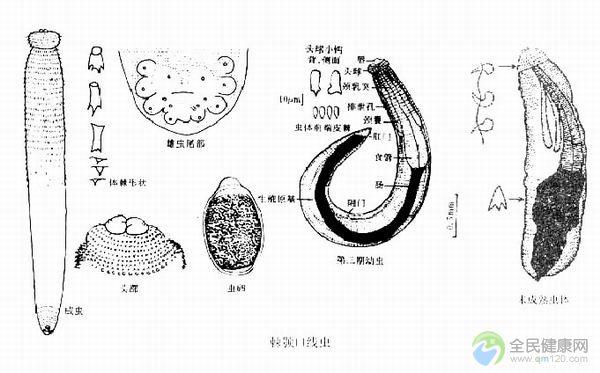 棘颚口线虫的介绍
