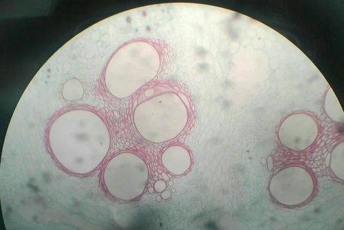 南瓜茎横切玻片