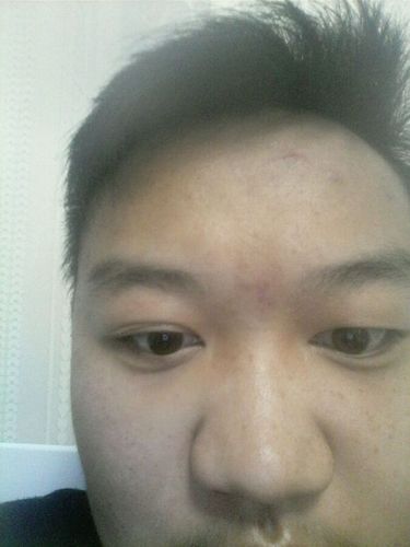 印堂发红看相分析