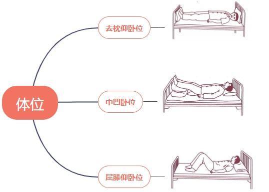 护理考试中必考的卧位竟然还有人不会