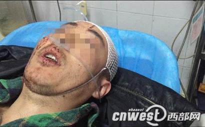 快递员被两男子殴打入院 被铁棍击伤头部流血严重