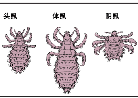 寄生虫与皮肤病有着密切关系.