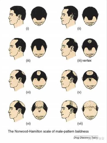 30岁,假如我成了地中海发型,生活会有哪些变化?