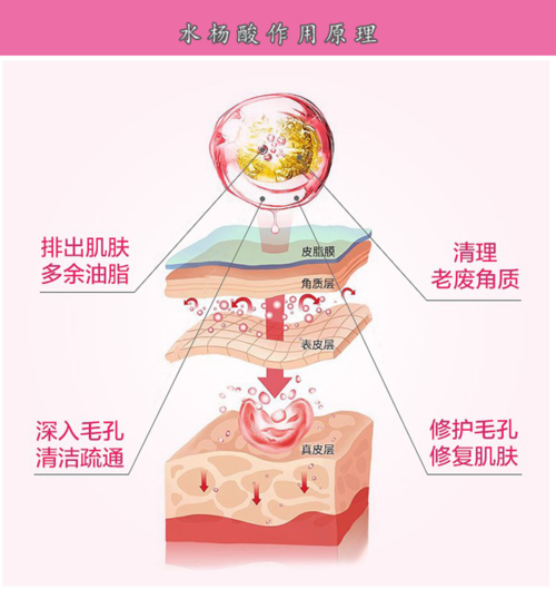 我们都知道水杨酸有去除皮肤老化角质堆积,改善皮肤纹理的作用