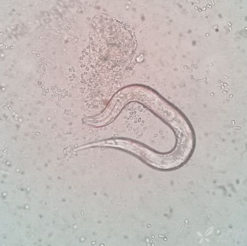 广州管圆线虫?