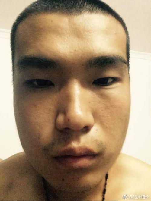 婚后家暴可能性非常大的一款面相,额头凹陷明显,学业