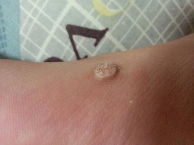 求大师给我看一下我脚上的这个是什么东西.