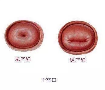 育儿知识  生过孩子的人都知道,如果是顺产,宫颈口会扩张到10里面