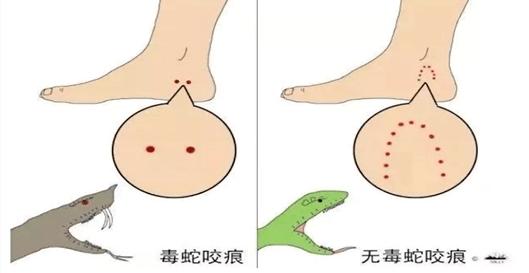 读(毒)蛇传丨别被民间方法误导,正确的蛇伤急救方法是