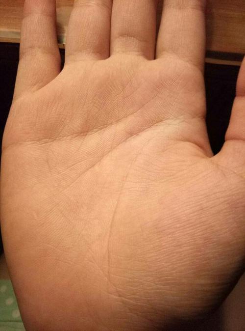 请问这样算感情线上是锁链状吗