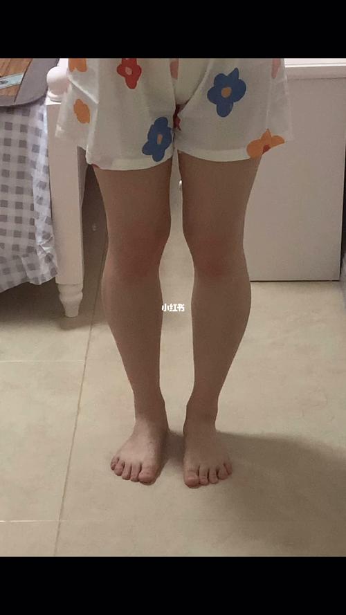 足弓塌陷型弯腿_教程_小腿外翻_运动健身_健身_徒手
