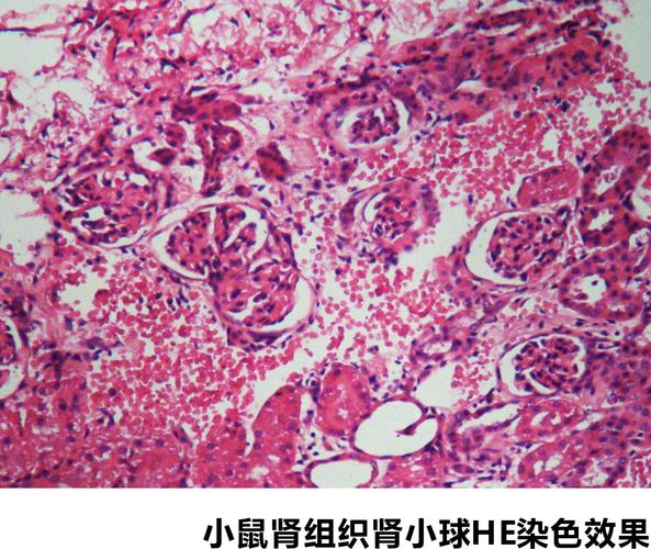 无毒环保苏木素-伊红(h-e)染液-病理染色液-产品专区