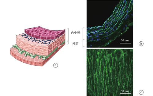 腹主动脉纵切面视图(外膜)figure2.
