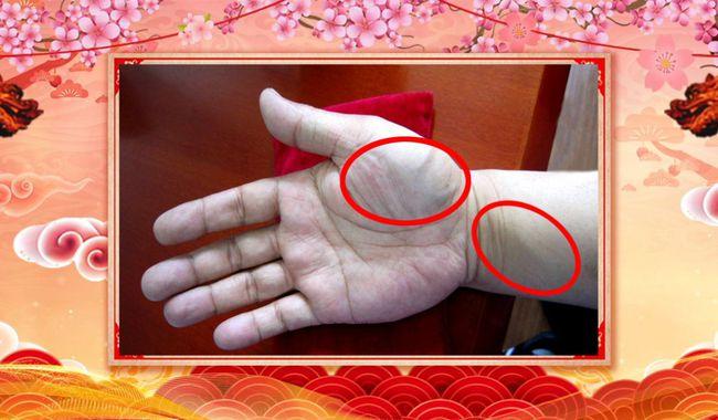 这几处变化可能藏大病|大鱼际