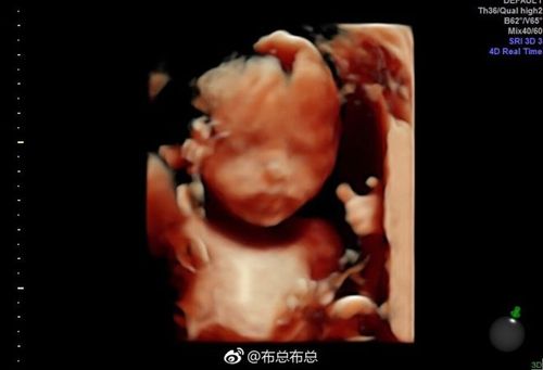 欧弟妻子晒二胎宝宝b超照 透露预产期和宝宝性别