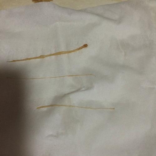 猪肉里抽出虫一样的东西,是线虫(猪肉里的寄生虫)?