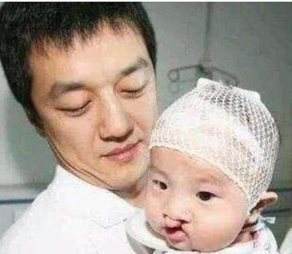 花百万做手术的王菲女儿嘴是治好了但脸却越来越奇怪