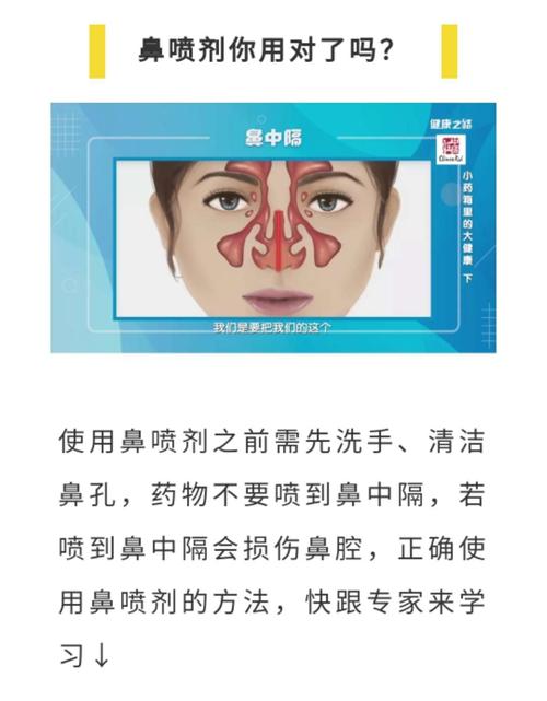 掌握正确使用鼻喷雾剂的方法!