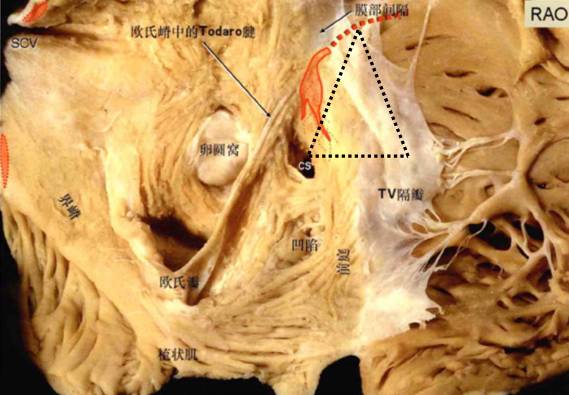 大半个世纪以来,人们对房室交界区解剖和电生理特点投入了极大的关注