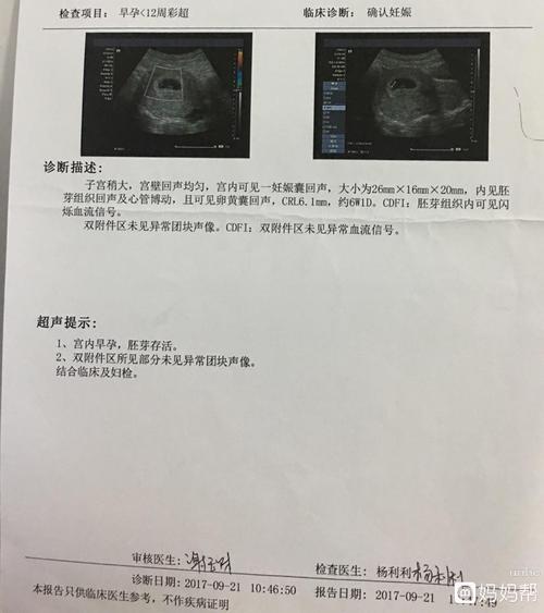 今天刚好足月,早上去产检就把所有的b超