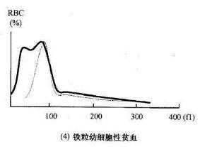 一分钟看懂血常规散点图和直方图!