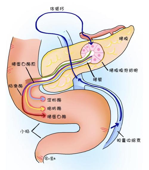 急性胰腺炎～胰腺的自我消化