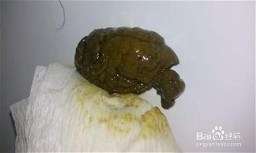 生活/家居 > 生活常识 1 解黑便是上消化道出血的常见病征,多见于溃疡