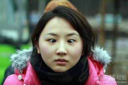 小孩斗鸡眼怎么治疗