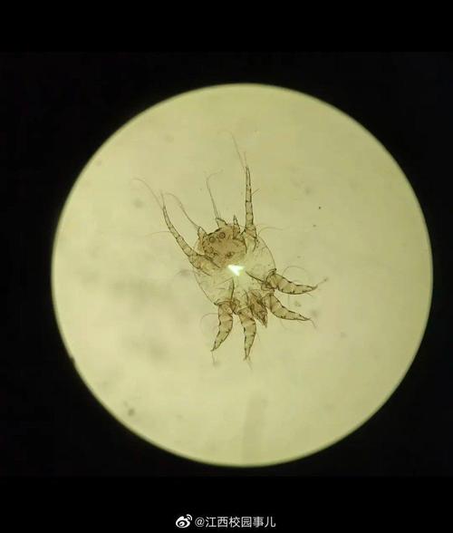 显微镜下的疥螨超可爱嘿嘿