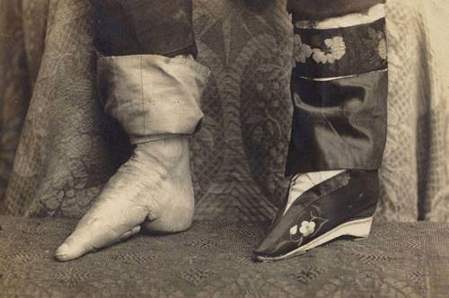 古代三寸金莲的秘密:竟能治阳痿