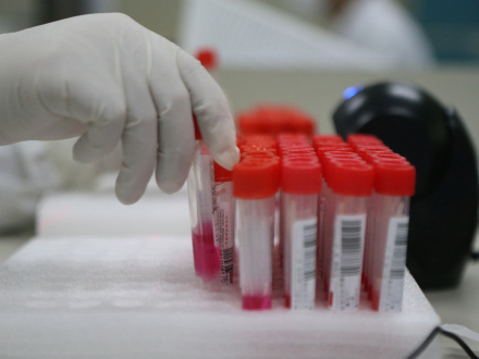 广州一入境人员解除隔离后新冠病毒核酸检测阳性