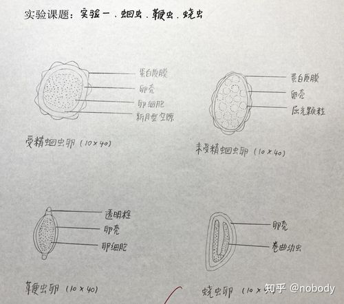 受精蛔虫卵 2.未受精蛔虫卵 3.鞭虫卵 4.