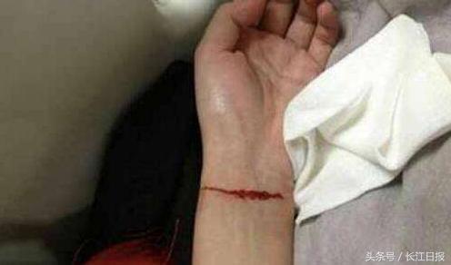 女生自残割手腕图片 - 搜狗图片搜索