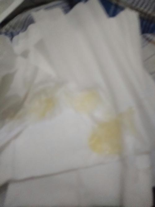 为什么很长时间都是这种精液.