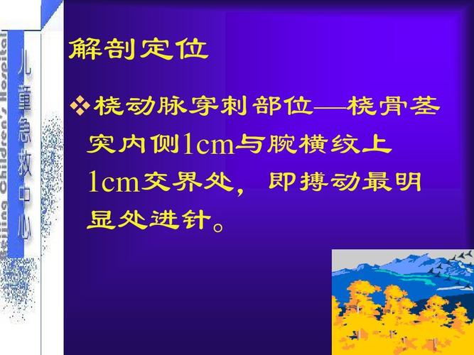 解剖定位  桡动脉穿刺部位—桡骨茎 突内侧1cm与腕横纹上 1cm交界处