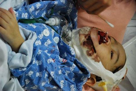 请伸出援手 救救小雅诗