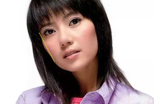 苹果肌和高颧骨有什么区别?