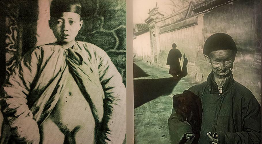 进行手术都是有经验的老太监,在净身前世需要将他们身体的东西全部排